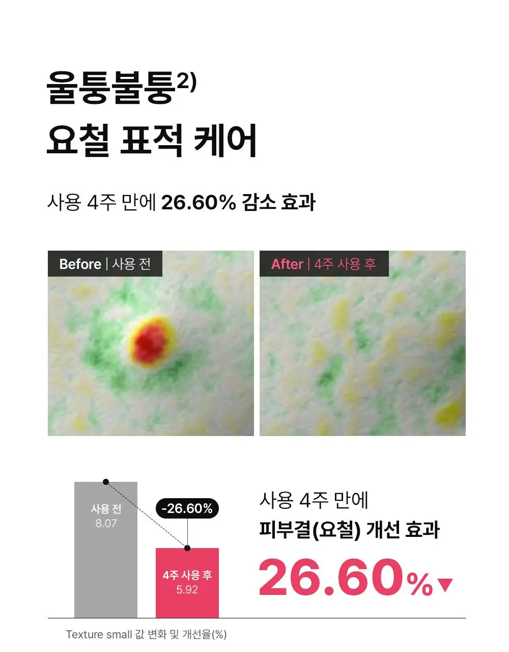 (하루특가)[단독기획] 동아제약 아크네 프로 크림제 30ml 기획(+3ml+겔제3ml) 상세페이지 14
